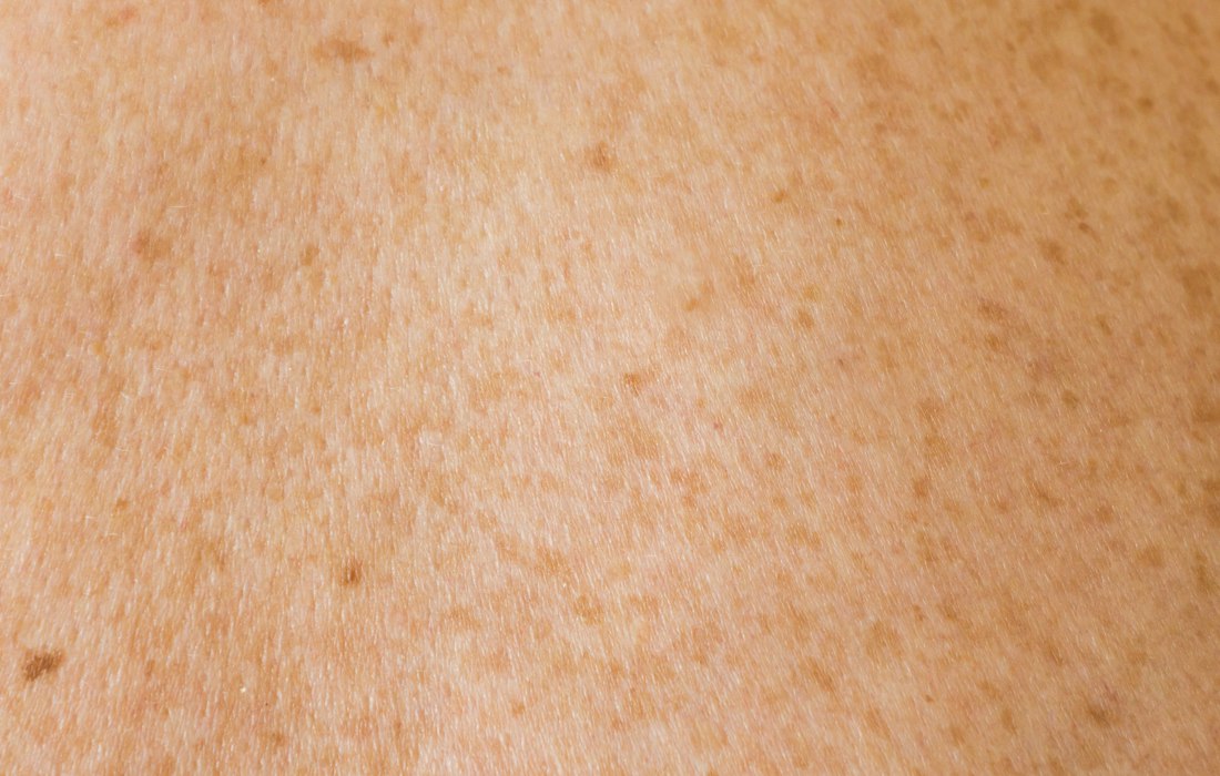 Your skin is one of the first places change shows
